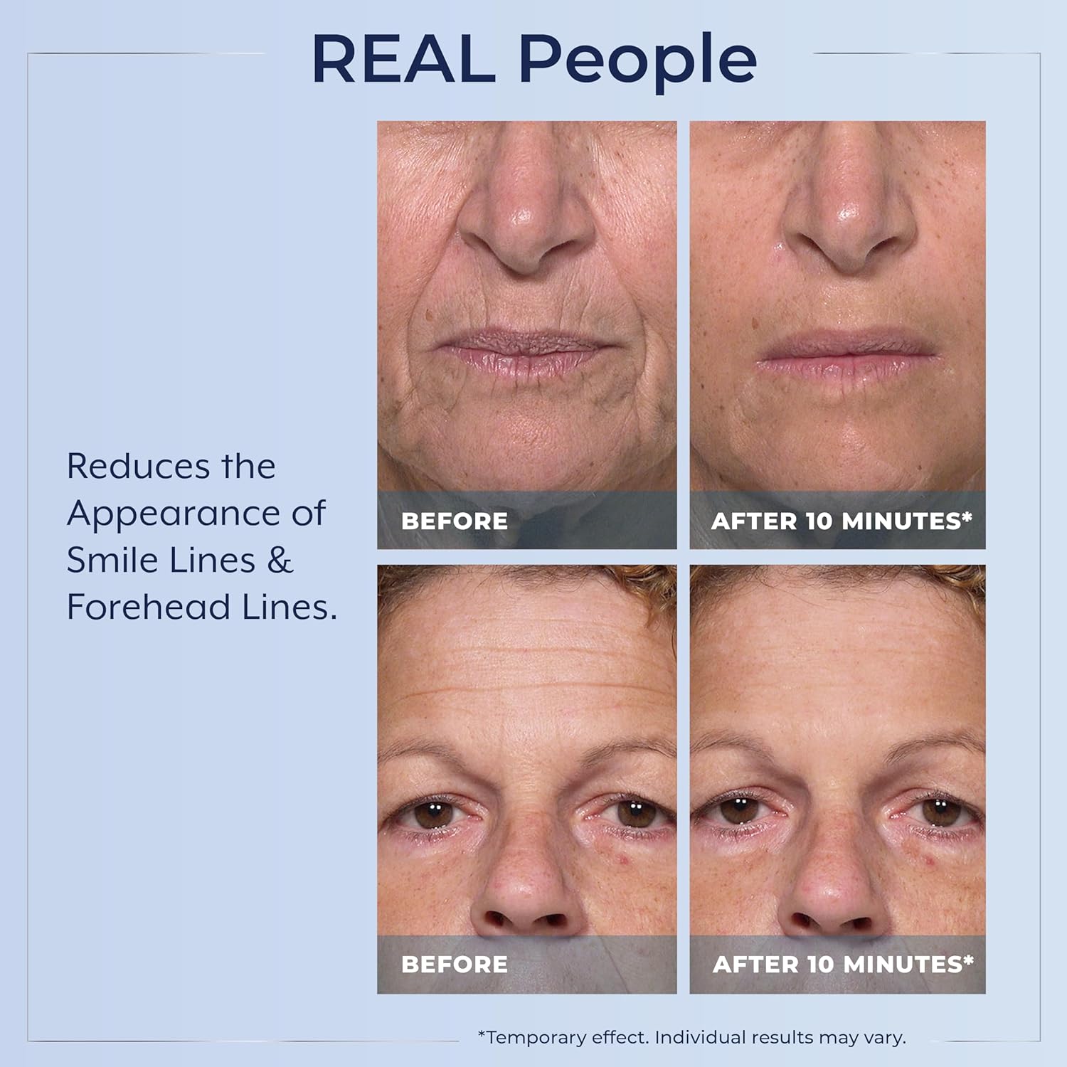 Plexaderm Rapid Reduction Eye Serum – Instantly Reduces Under-Eye Bags, Wrinkles