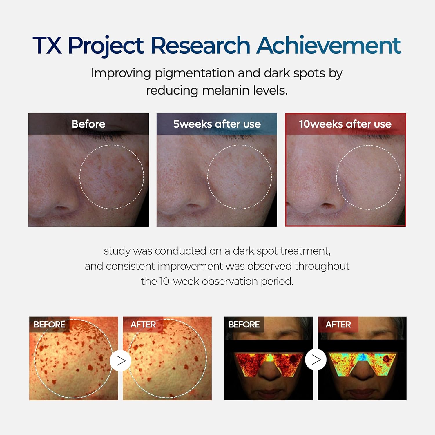 DR.Melaxin TX Tranexamic Acid Cream – Anti-Freckle & Anti-Pigmentation Skin Crea