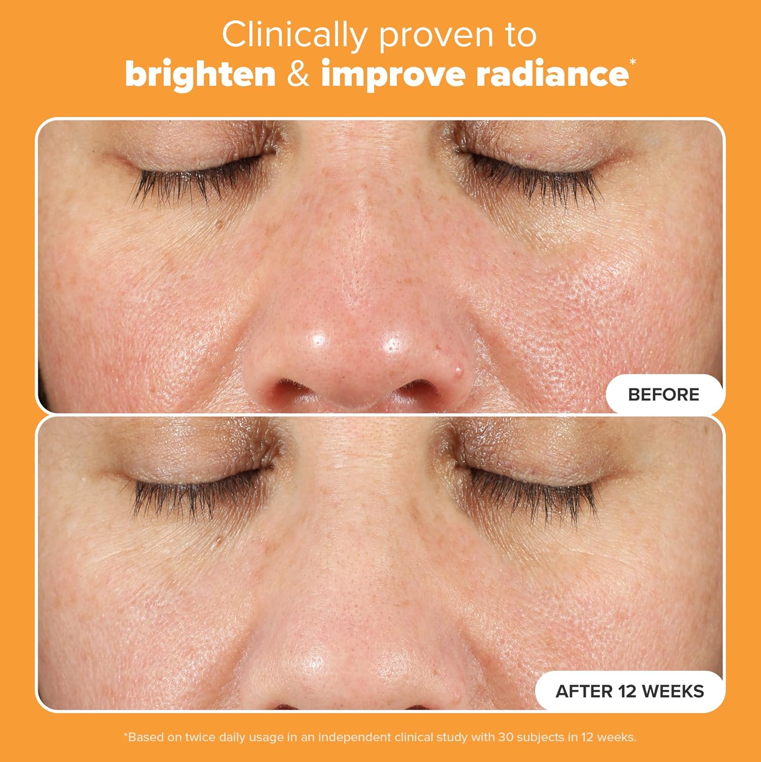 Paula's Choice BOOST C15 Super Booster – 15% Vitamin C Serum for Face with Vitam