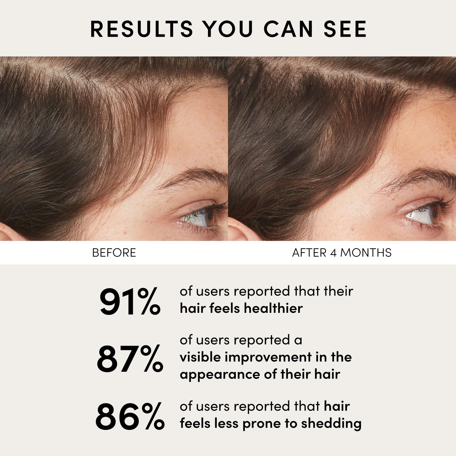 OUAI Scalp Serum – Hair & Scalp Treatment with Red Clover, Siberian Ginseng & Pe