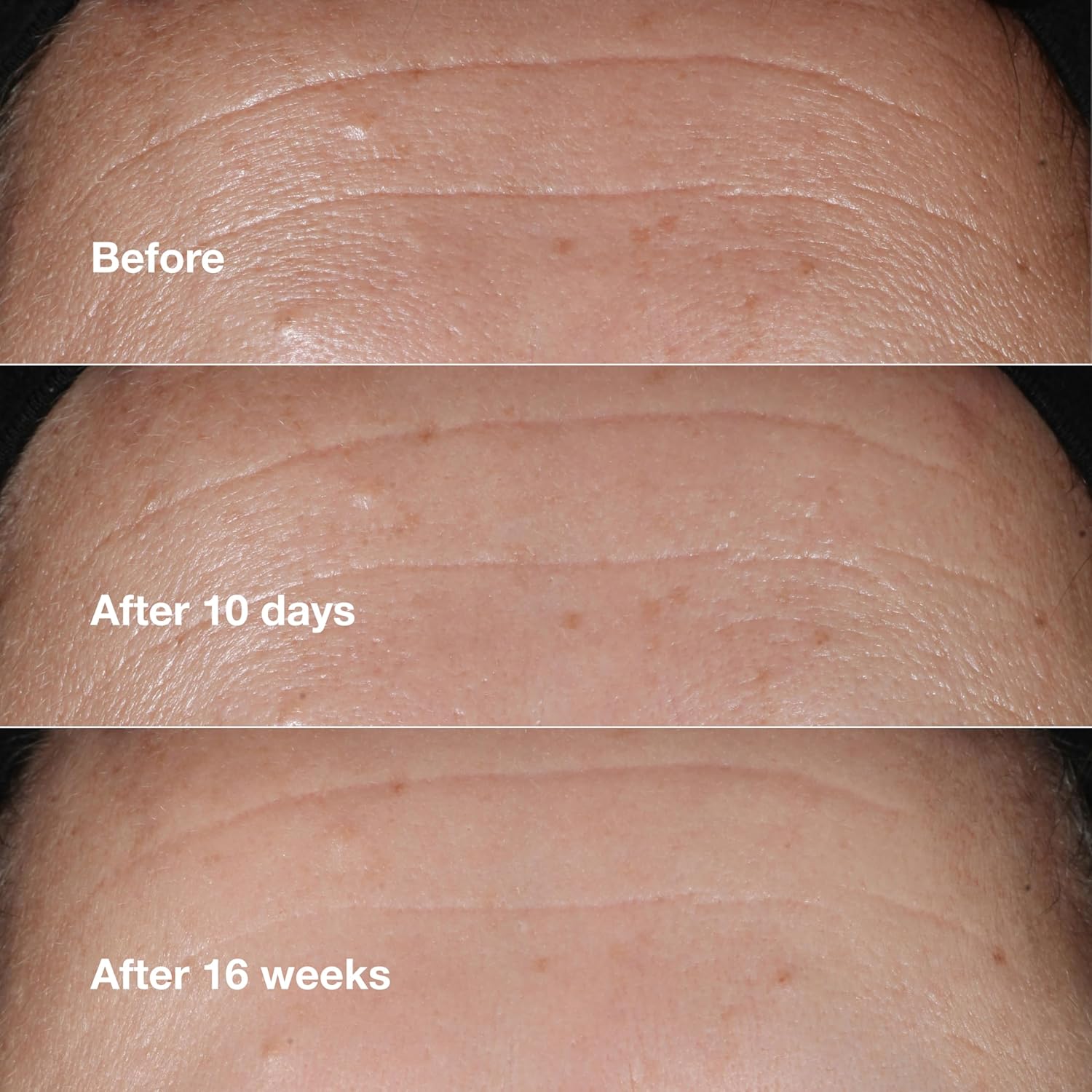 Clinique Smart Clinical Repair Wrinkle Correcting Face Serum – Anti-Aging Serum 