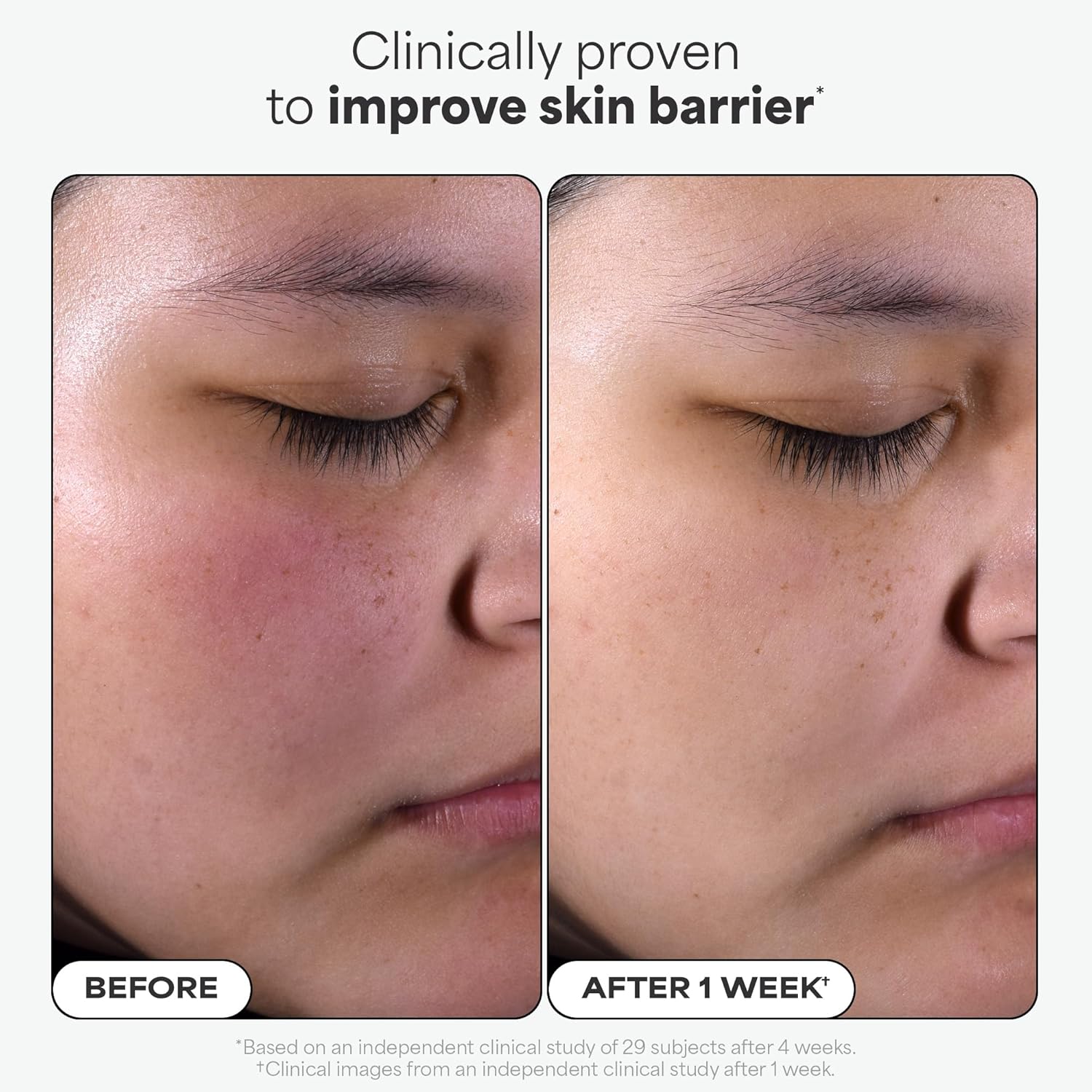 Paula's Choice SKIN PERFECTING 2% BHA Liquid Exfoliant – Salicylic Acid Facial T