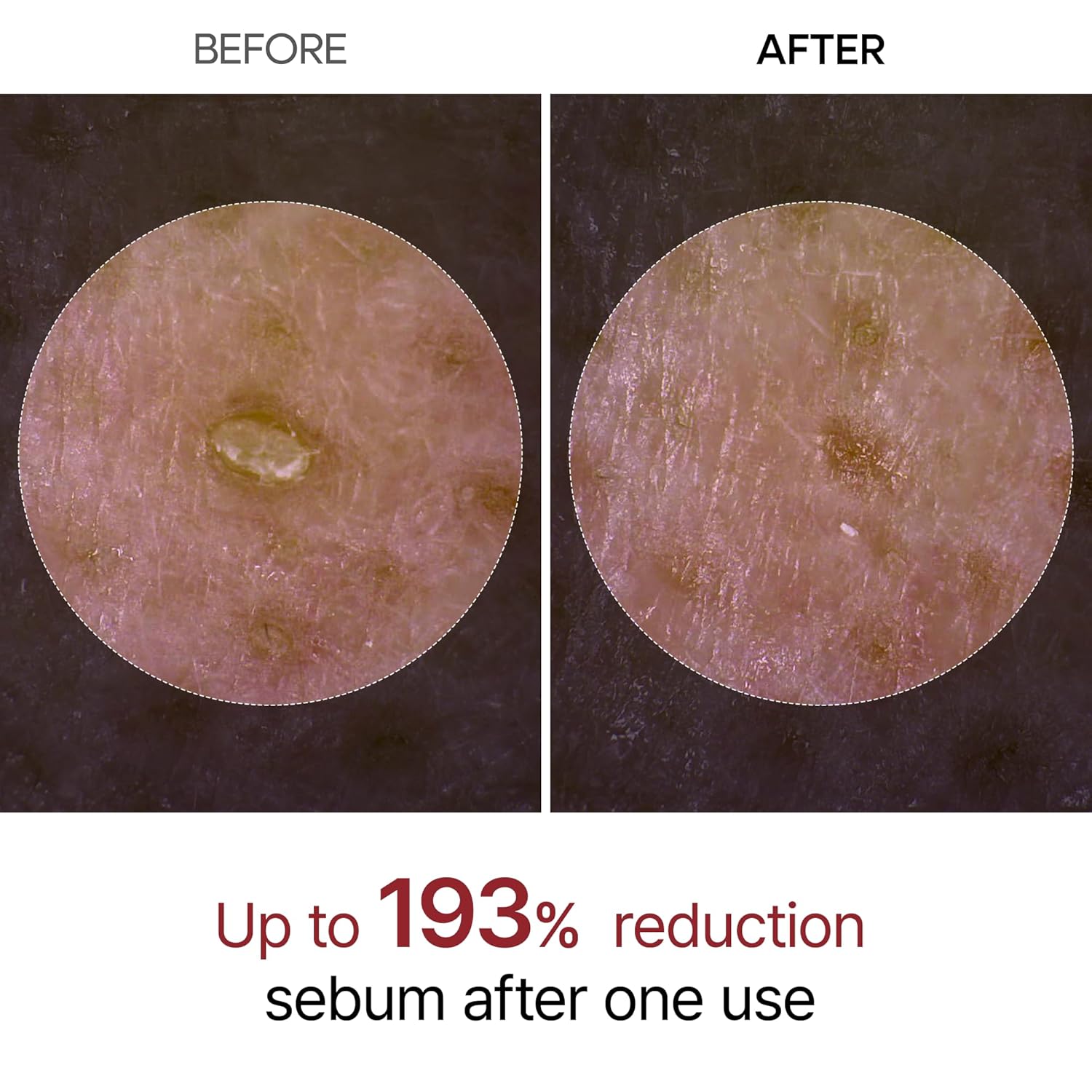 Dr. Melaxin Peel Shot Glow Rice Peeling Ampoule 80ml – Daily Gentle Exfoliating 