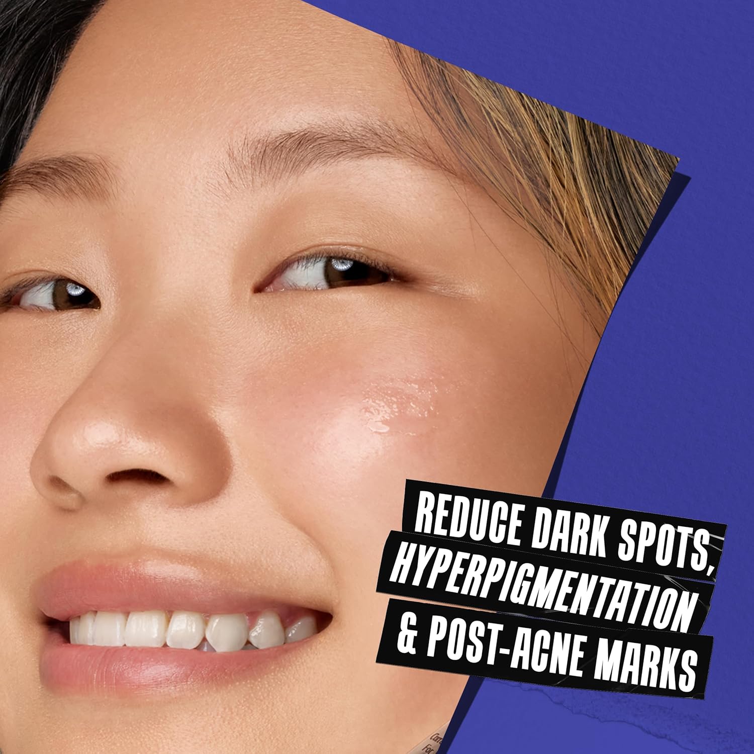 Kiehl’s Clearly Corrective Dark Spot Serum 3.4 fl oz – Vitamin C Brightening Serum for Hyperpigmentation & Post-Acne Marks