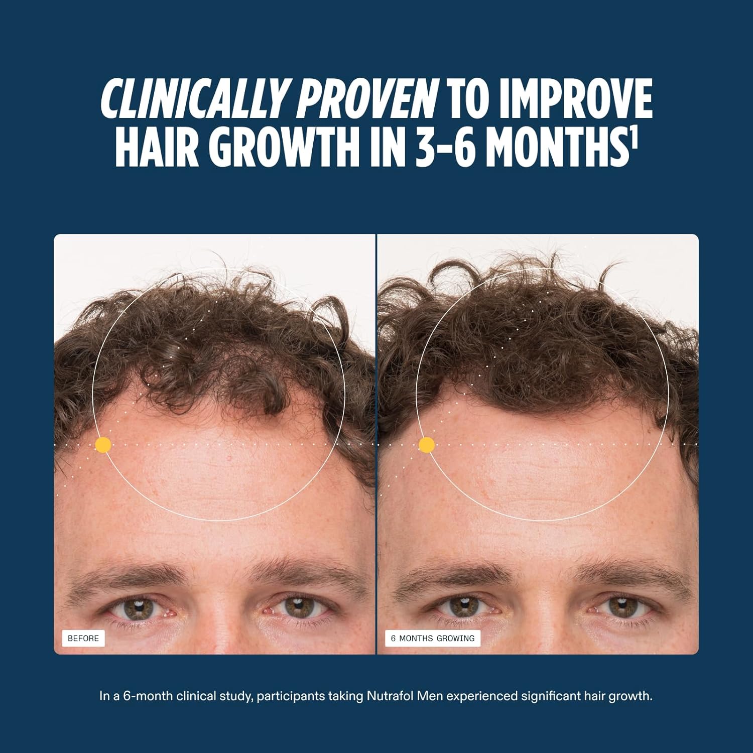 Nutrafol Men’s Hair Growth Supplements – Thicker Hair & Scalp Support 1 Month Supply 120 Capsules