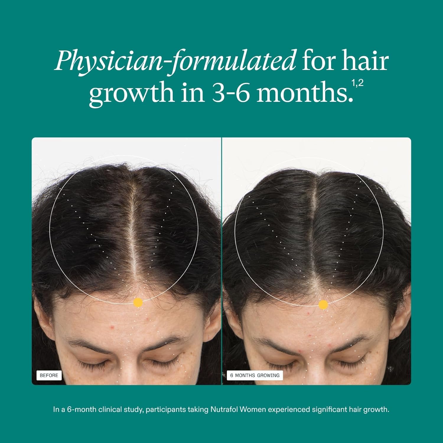 Nutrafol Women’s Hair Growth Supplements 18–44 – Thicker, Stronger Hair 1 Month Supply USA